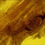 Личинка трихинеллы в мышцах1